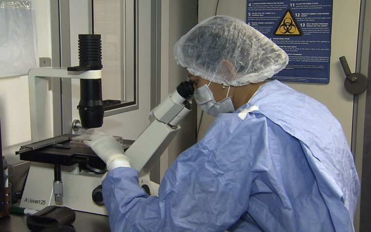 Cientistas avançam na cura de pacientes com HIV após transplantes