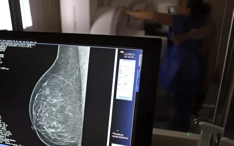 Cobertura de mamografia digital é ampliada para todas as idades