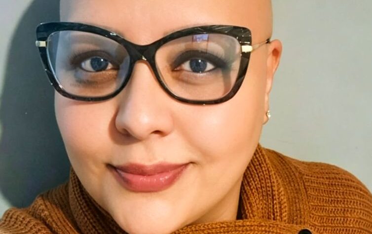 Superação e autoestima: histórias inspiradoras contra a alopecia areata